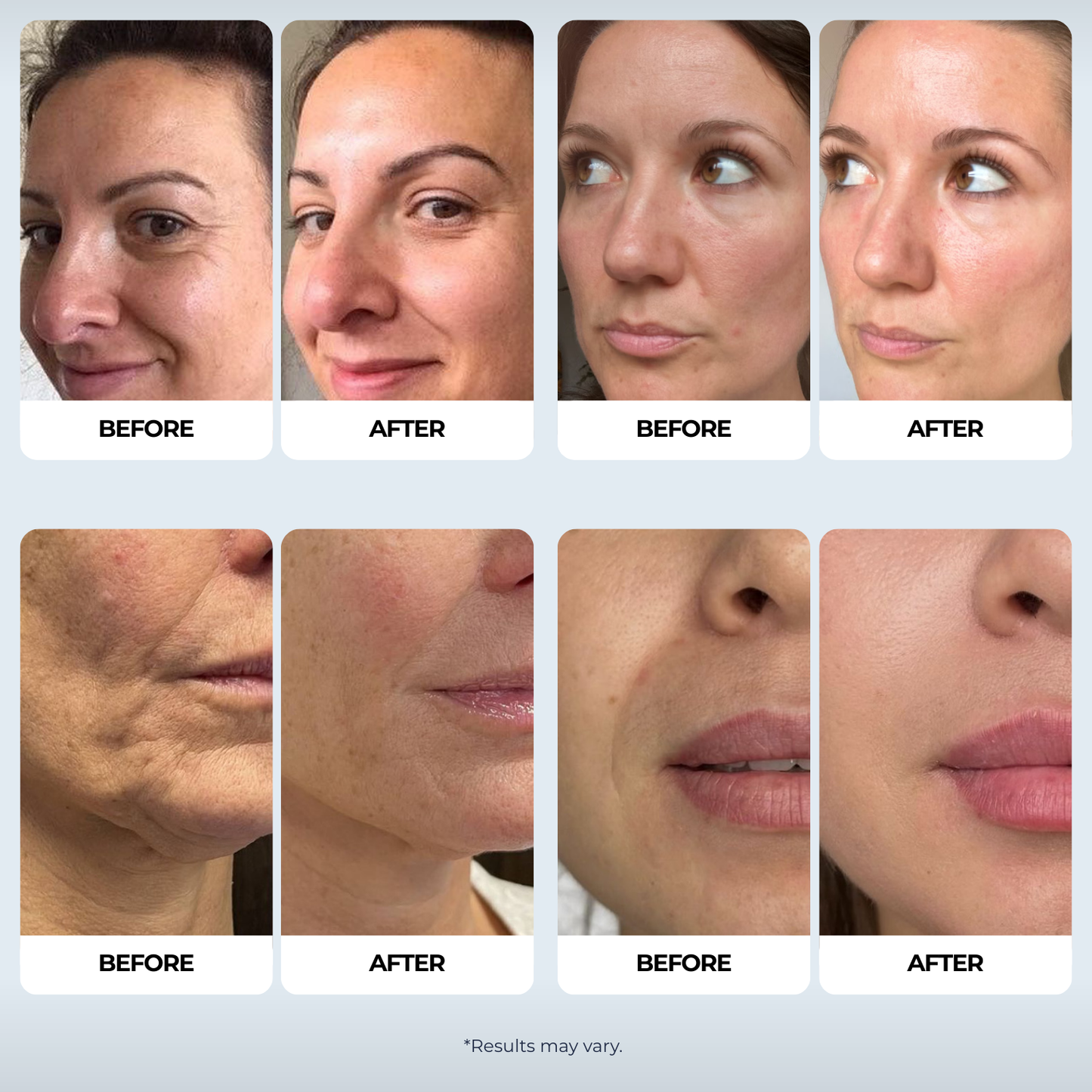 Noor Marine Collagen