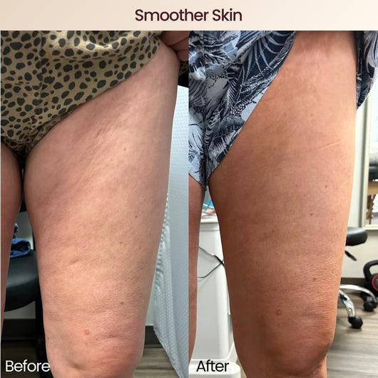 NOOR Collagen Tripeptides